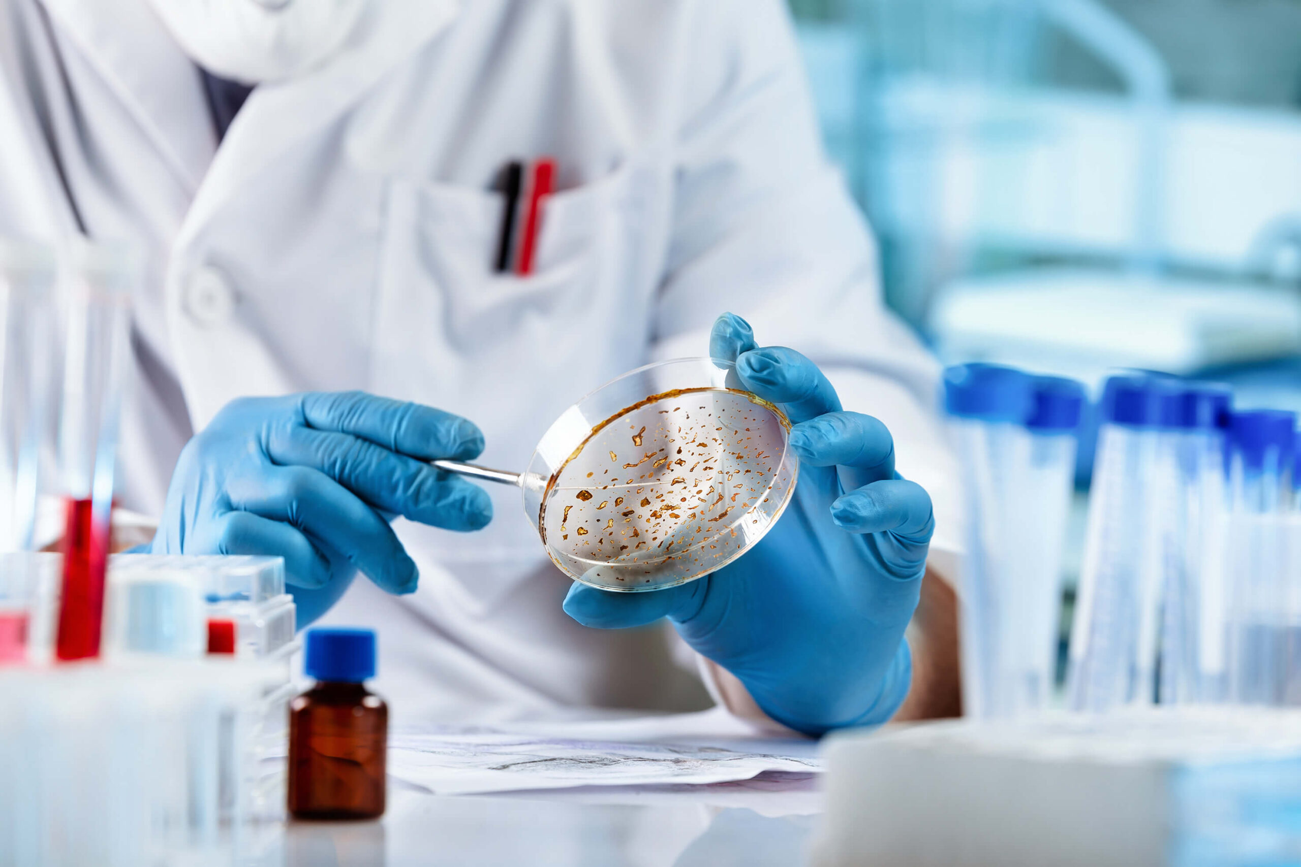 Person in Labor, bekleidet mit Laborkittel und blauen Handschuhen hält Petrischale und Pinzette in der Hand